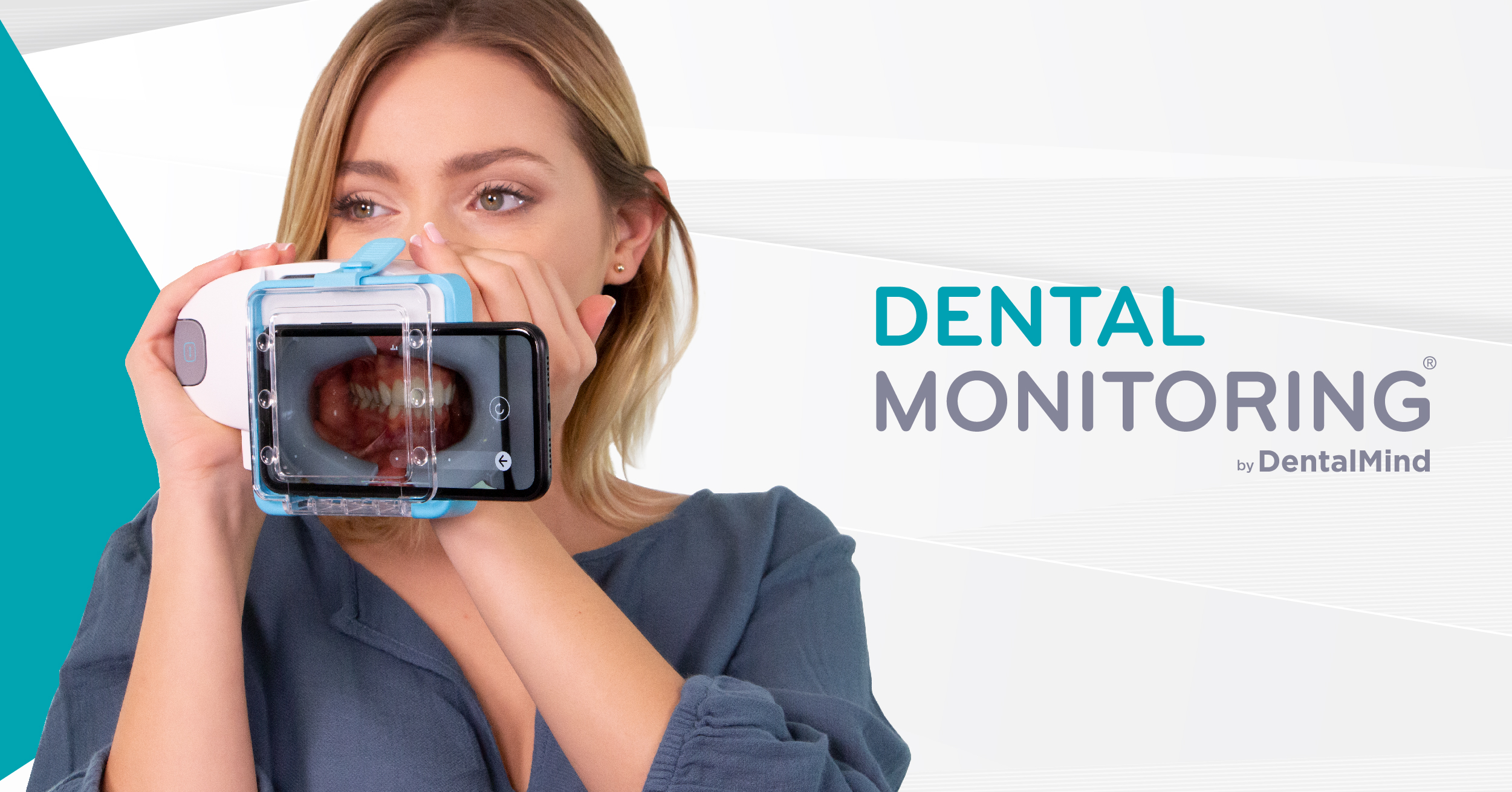 Dental Monitoring Treatment Made Simple Miller Orthodontics 